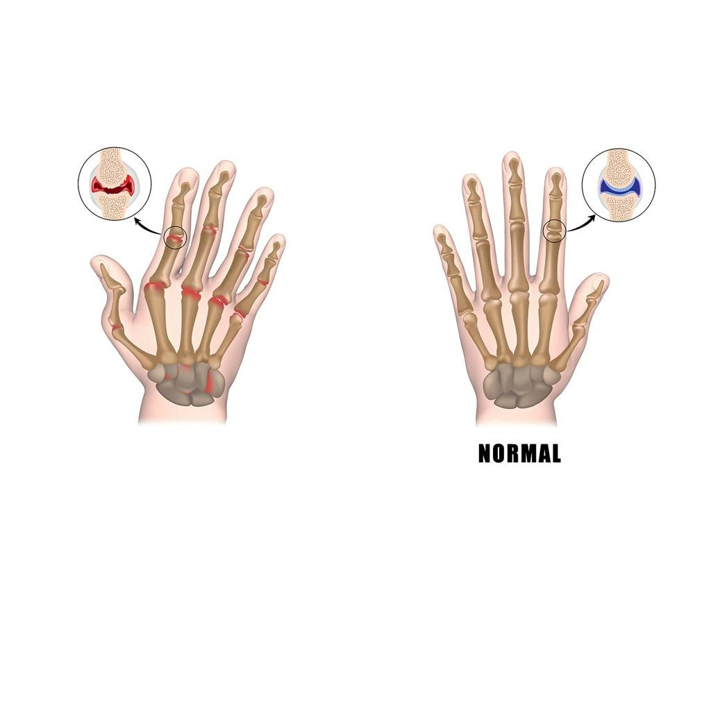 Luva Magnética de Compressão - Alivio nas Dores Articulares