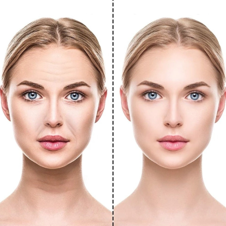 Adesivos De Silicone Para Rugas, Antissinais