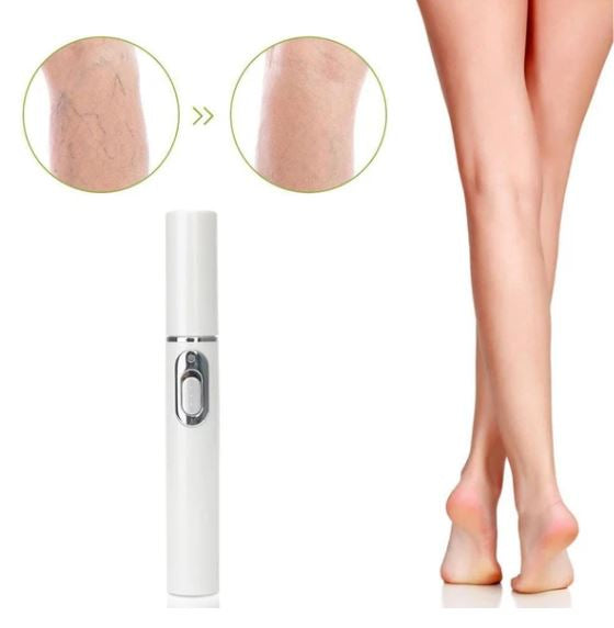 Caneta Laser Remoção de Varizes, Rugas e Acne